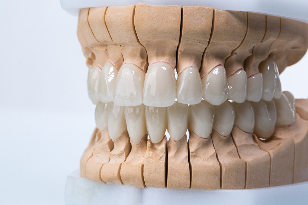 A relevant stock photo of zirconia in a typical setting.